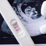 Pregnancy test next to an ultrasound image and two white tablets