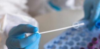 Healthcare professional holding a swab next to a tray of sample vials