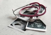 Stethoscope on ultrasound photos