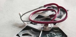 Stethoscope on ultrasound photos