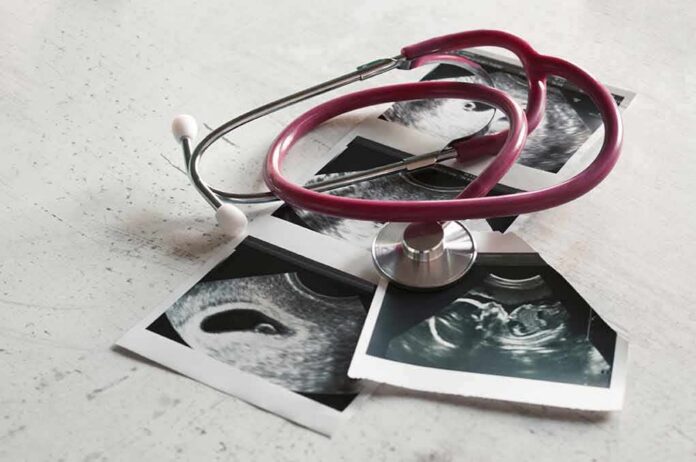 shutterstock_1224842371 Stethoscope on ultrasound photos
